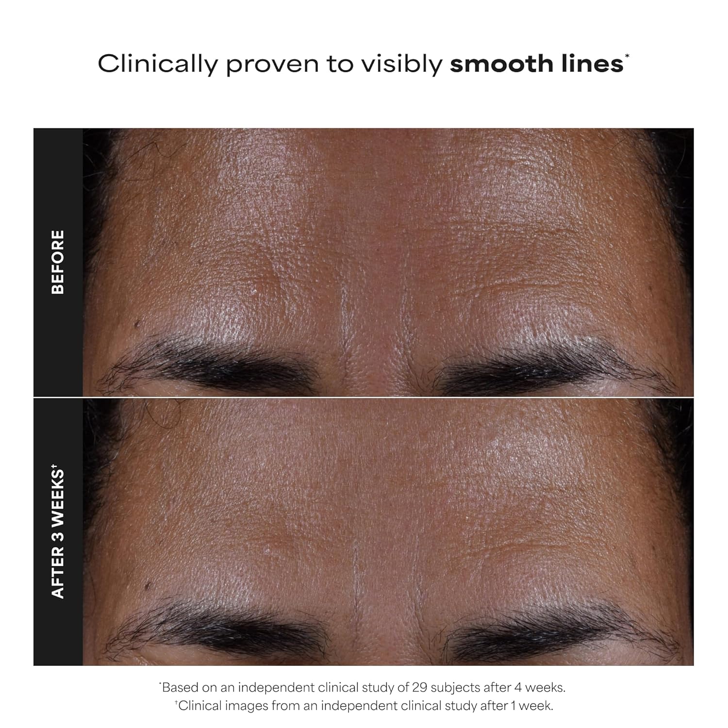 Paulas Choice--SKIN PERFECTING 2% BHA Liquid Salicylic Acid Exfoliant--Facial Exfoliant for Blackheads, Enlarged Pores, Wrinkles & Fine Lines, 4 oz Bottle