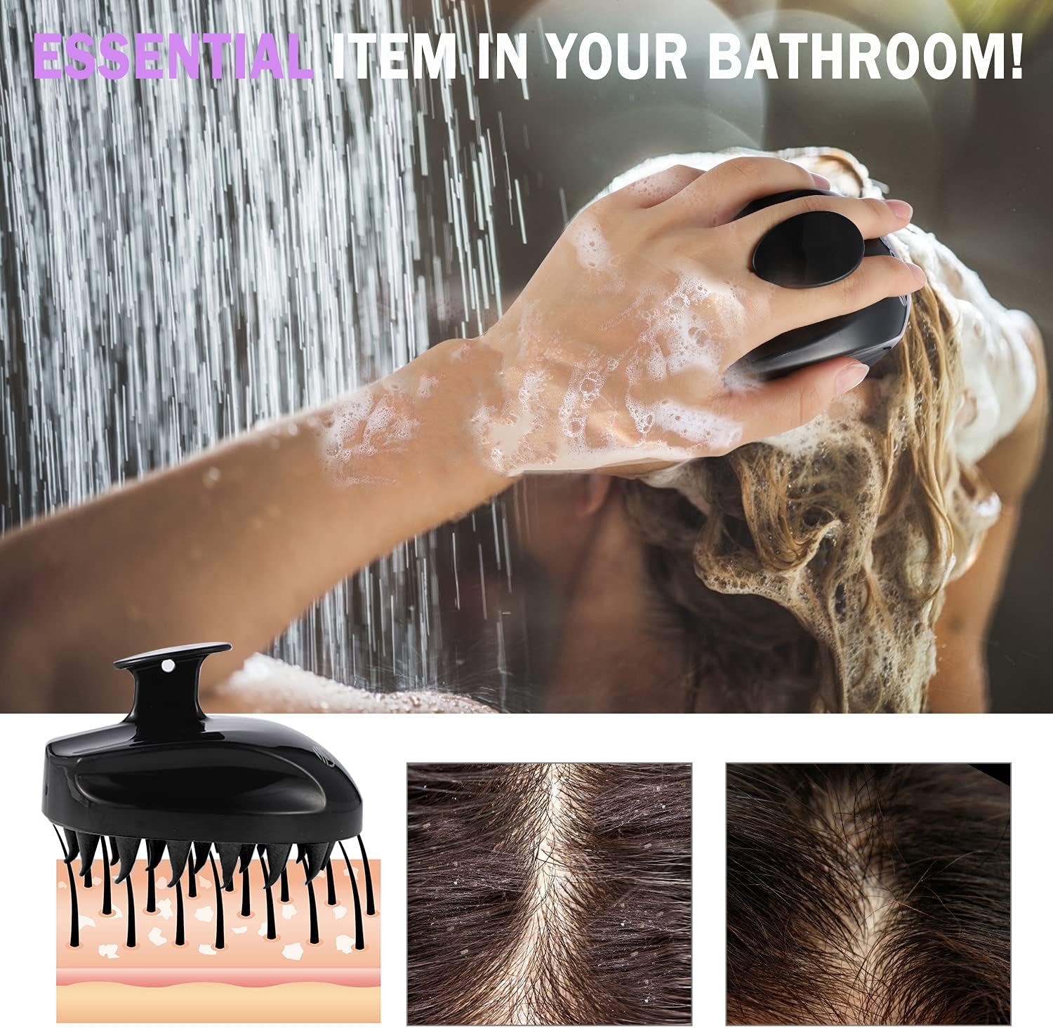 Sosoon Scalp Massager Shampoo Brush, Hair Scalp Scrubber Shower Hair Brush Head Massager for Stress Relax Hair Growth, Dandruff Brush Scalp Exfoliator for Women Men Kids Pets, Black